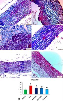 Hibiscus attenuates renovascular hypertension–induced aortic remodeling dose dependently: the oxidative stress role and Ang II/cyclophilin A/ERK1/2 signaling